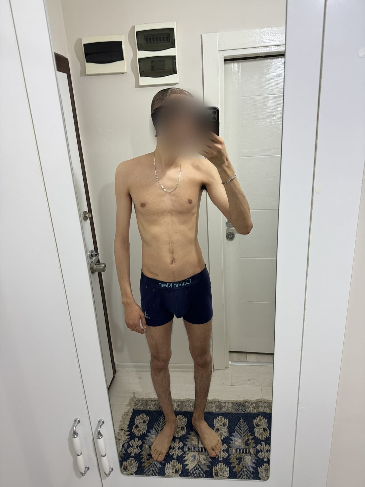 Day 1 at 59 kg, full body mirror photo, very thin arms and legs